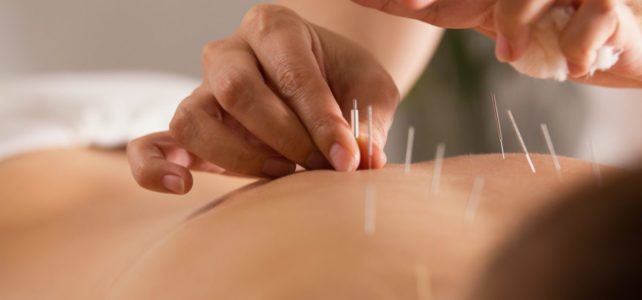 acupuncture Melbourne CBD